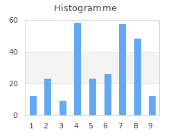 Histogramme avec JpGraph